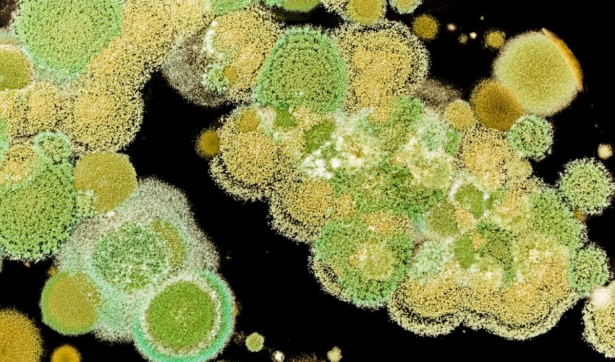 Climate-change-may-be-increasing-risk-of-fungal-diseases-850x500 (1)