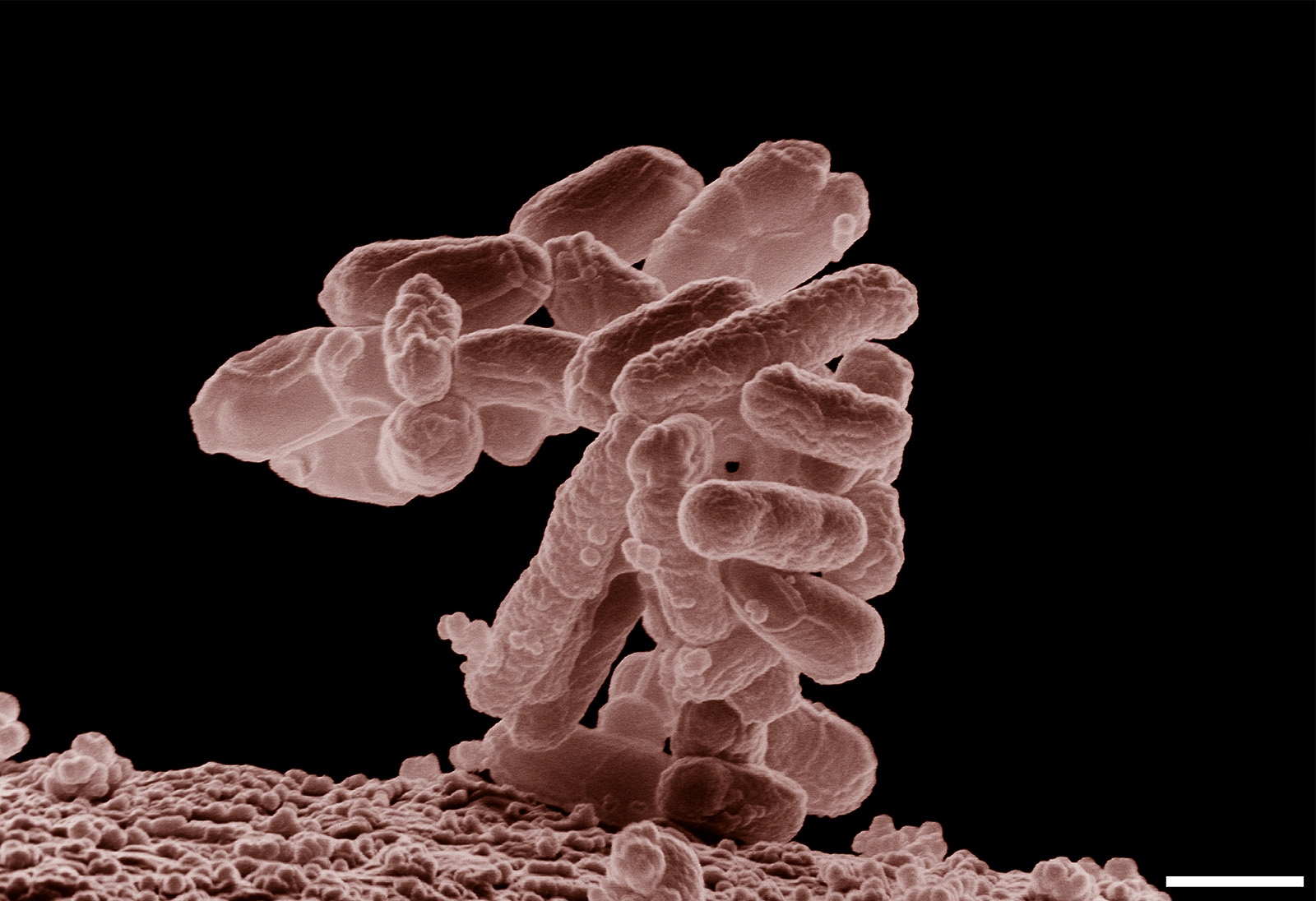 E_coli_at_10000x (1)