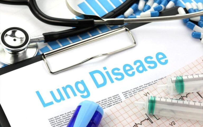 Καρκίνος του πνεύμονα: Ο προσυμπτωματικός έλεγχος βελτιώνει σημαντικά τη μακροπρόθεσμη επιβίωση των ασθενών