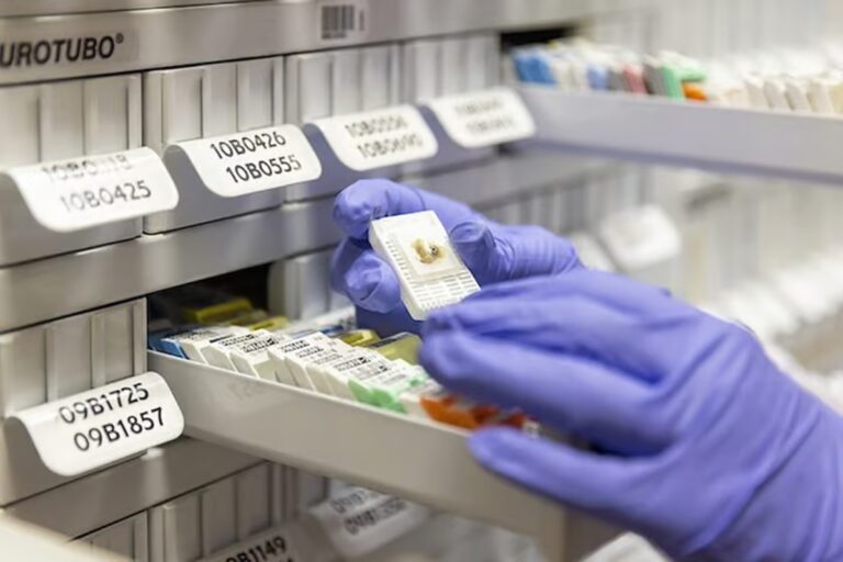 Ισπανία: Μια πρωτοποριακή βιοτράπεζα ανοίγει νέους δρόμους στην έρευνα για τον καρκίνο