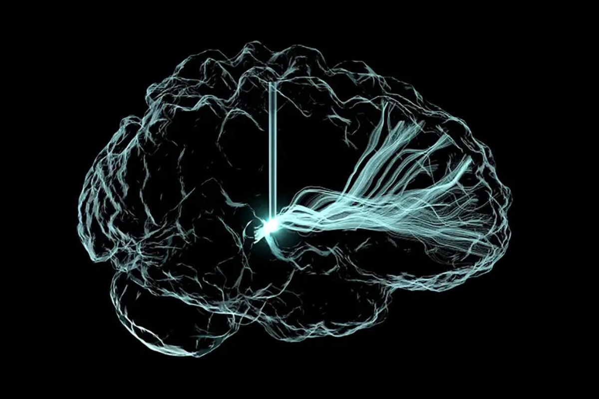 Πειραματική συσκευή βελτιώνει τη λειτουργία του εγκεφάλου σε ασθενείς με τραυματικές εγκεφαλικές κακώσεις