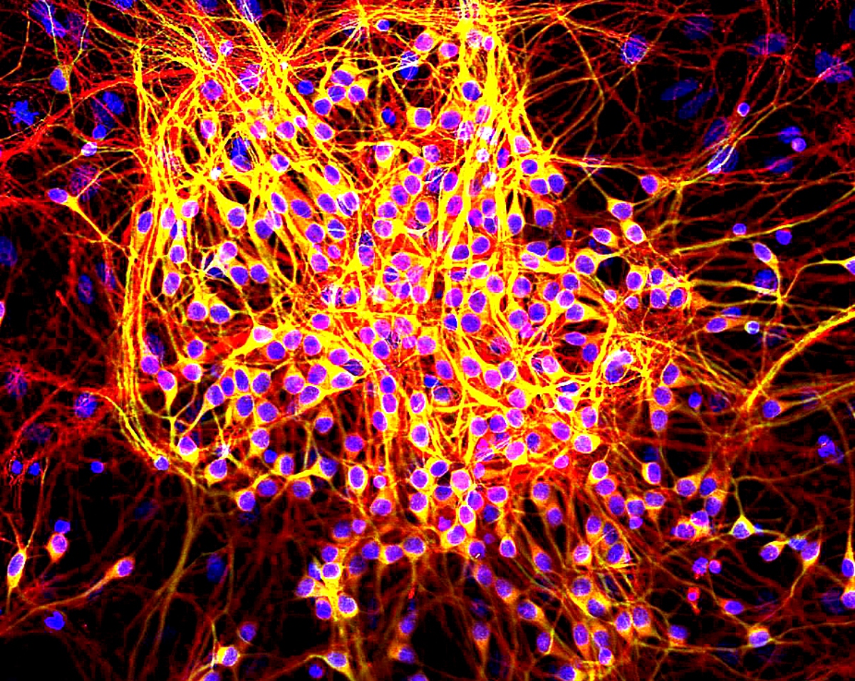 MAP2-tau_in_neurons (1)