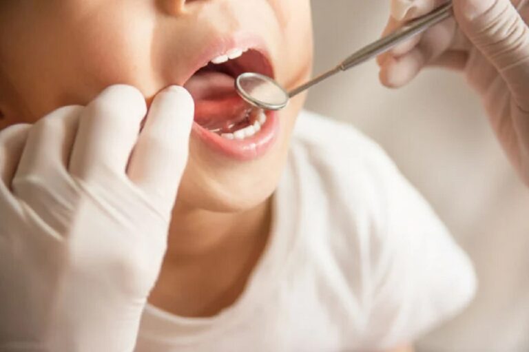 Dentist Pass: Τι παρέχει και πότε λήγει η προθεσμία για τις αιτήσεις