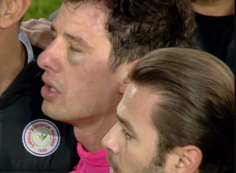 Τουρκία: Αναβολή επ’ αόριστον όλων των ποδοσφαιρικών αγώνων μετά την επίθεση που δέχθηκε διαιτητής από πρόεδρο ομάδας