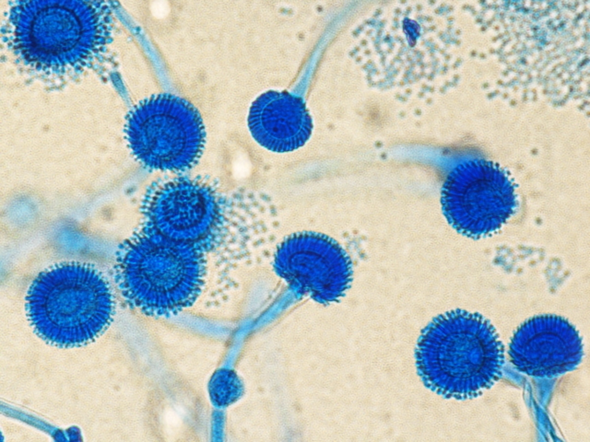 Antonio_e_Biagio_e_Cesare_Arrigo_Aspergillus_fumigatus_01 (1)