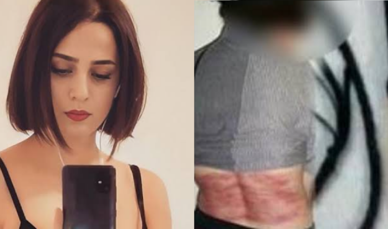Ιράν: Ποια είναι η γυναίκα που μαστιγώθηκε 74 φορές επειδή αρνείται το χιτζάμπ – «Δεν τους άφησα να πιστέψουν ότι ένιωσα πόνο»