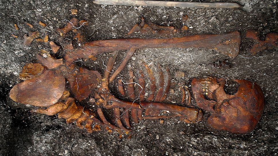 Βραζιλία: Ανακαλύφθηκε DNA συγγενικού βακτηρίου της σύφιλης σε σκελετούς ηλικίας 2.000 ετών