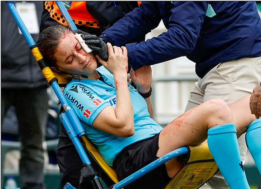 Hikma left the field bleeding after colliding with the camera (video)