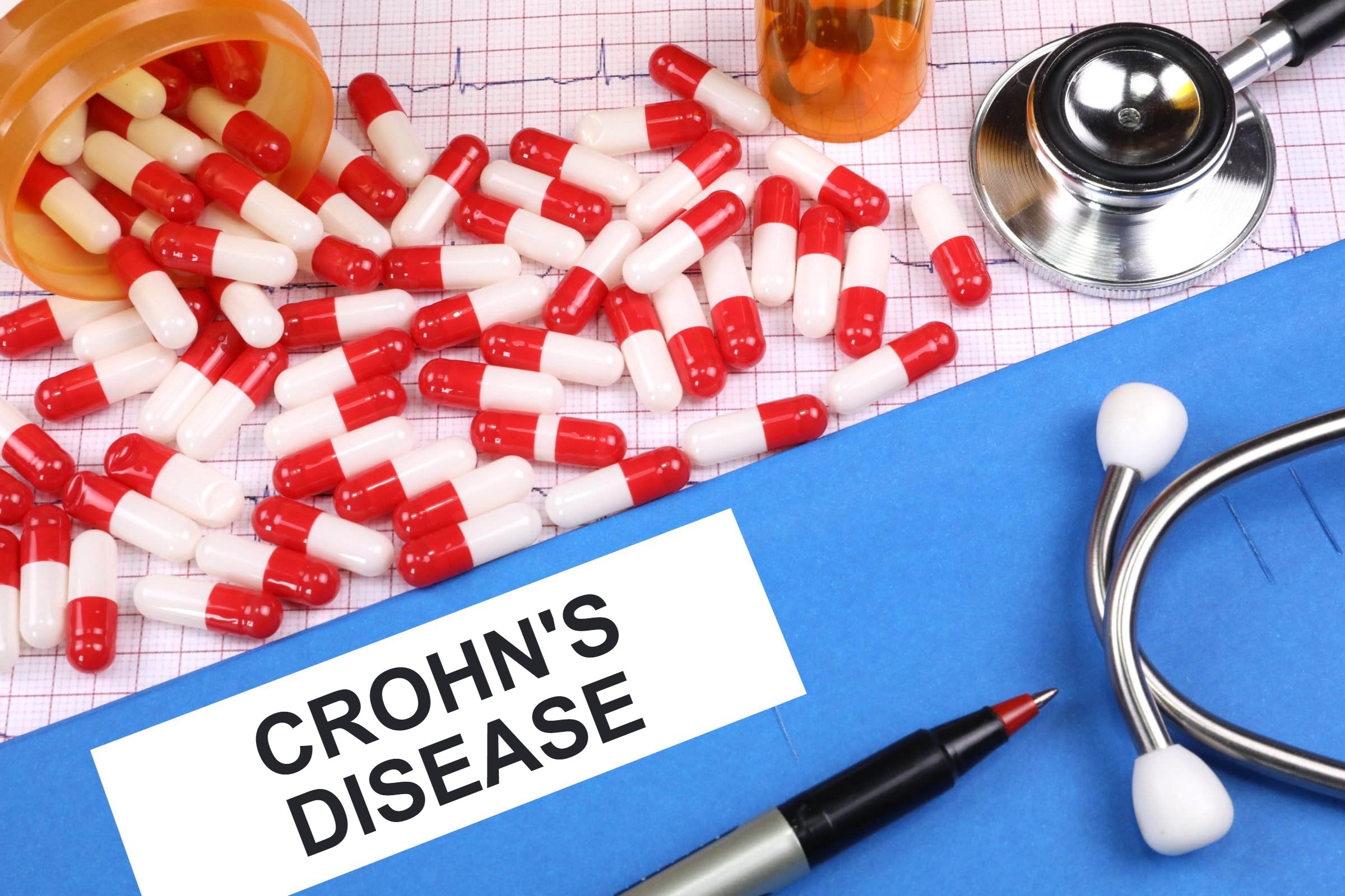 Νόσος του Crohn: Φάρμακο μειώνει την ανάγκη για χειρουργική επέμβαση