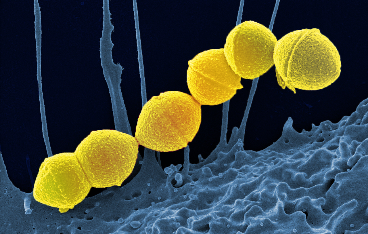 Streptococcus_Pyogenes_(Group_A_Strep)_(52602981880)