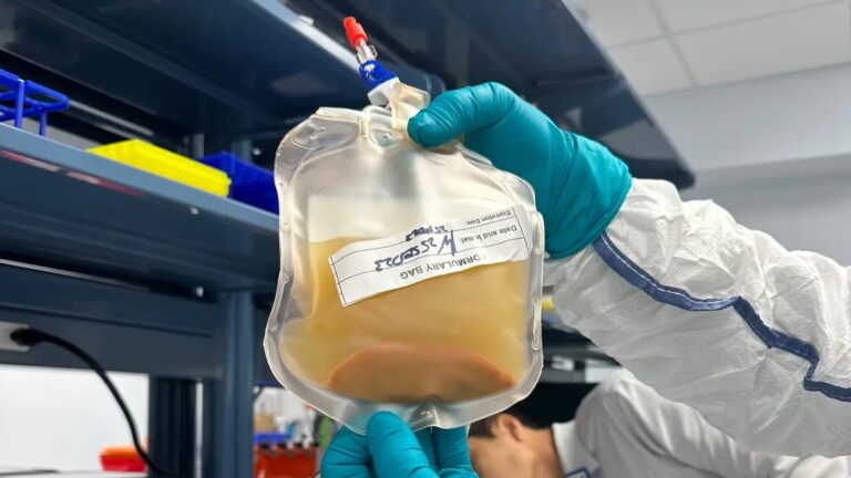 Πρωτοποριακή θεραπεία προσφέρει ελπίδα σε ασθενείς με ηπατική ανεπάρκεια τελικού σταδίου