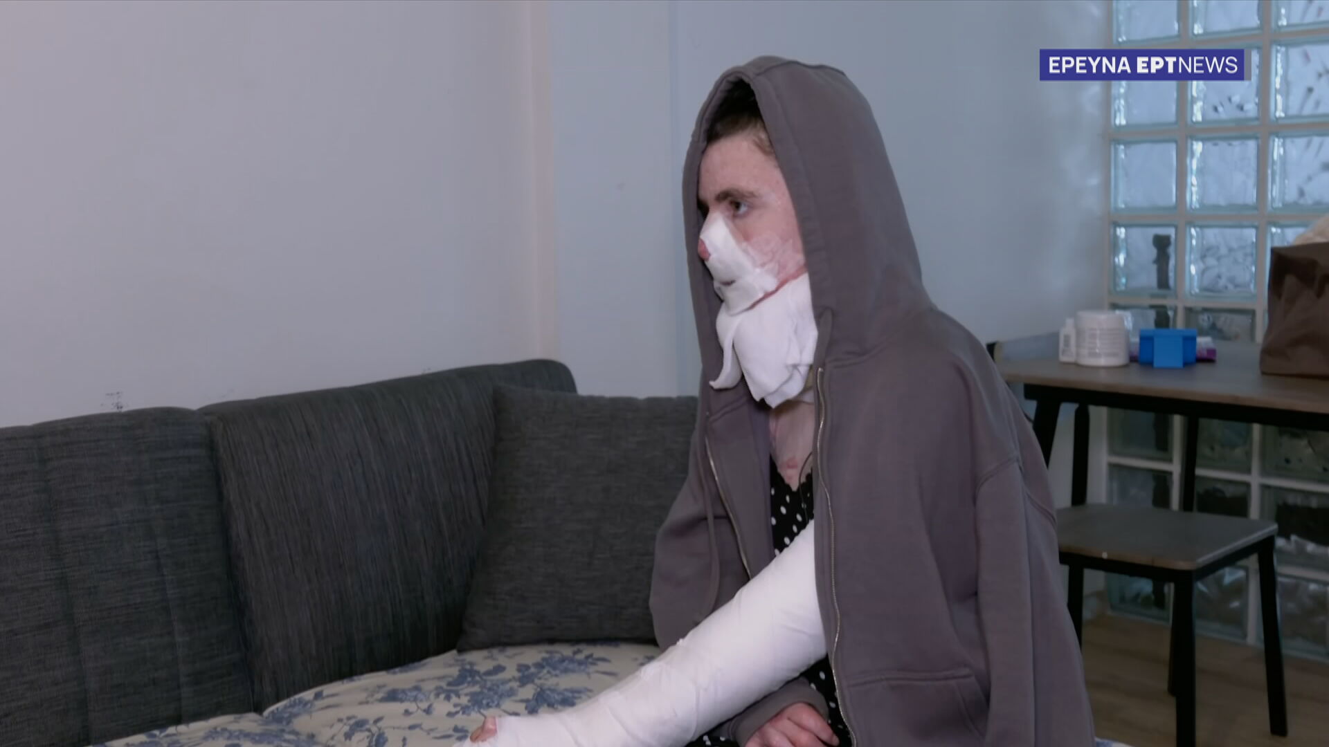 Τραύματα σε σώμα και ψυχή: Εγκαυματίες μιλούν στο ΕΡΤNews για τη μακρόχρονη νοσηλεία τους και τους αφόρητους πόνους