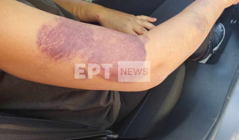 Διδυμότειχο: Στη φυλακή ο 35χρονος που κατηγορείται ότι κρατούσε φυλακισμένη και βίαζε τη σύντροφό του
