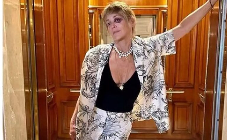 Σάρον Στόουν: Το μαυρισμένο μάτι της προκάλεσε ανησυχία στους θαυμαστές – Τι ακριβώς συνέβη
