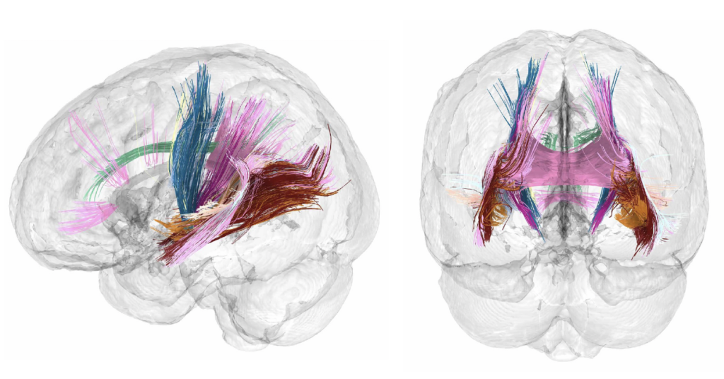 https://www.ertnews.gr/wp-content/uploads/2024/09/brainchangespregnancy-1024x536.png