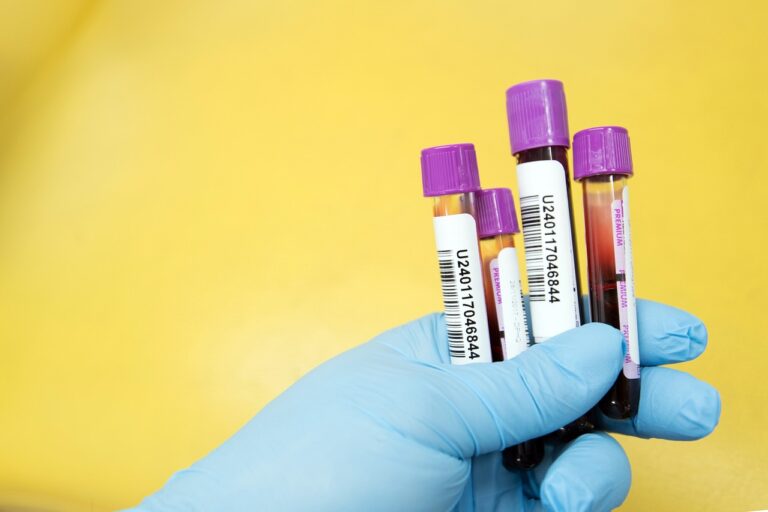 Αλτσχάιμερ: Νέοι βιοδείκτες θα μπορούσαν να προβλέψουν έγκαιρα τη νόσο