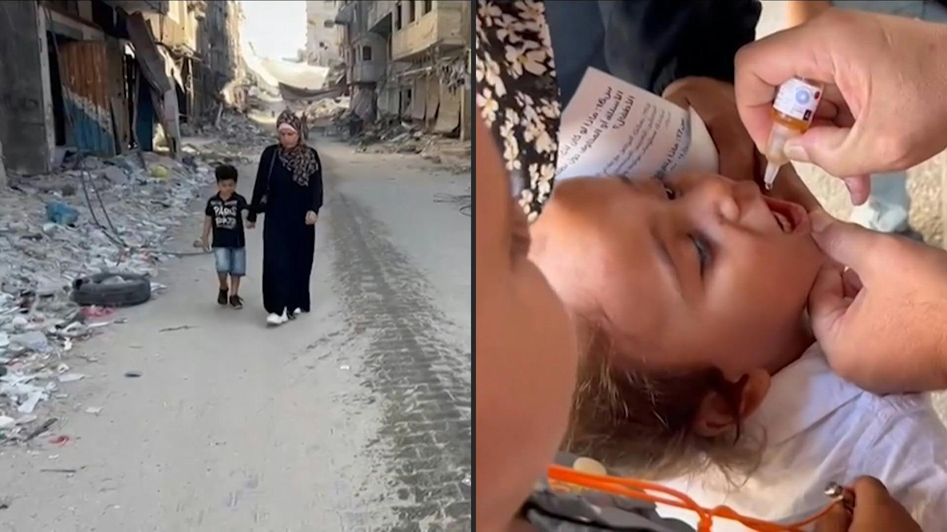 AFP-TV_20240912_HTH_PSE_VaccinesPolio_36G36R8_en