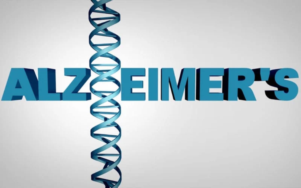 Alzheimer (2)