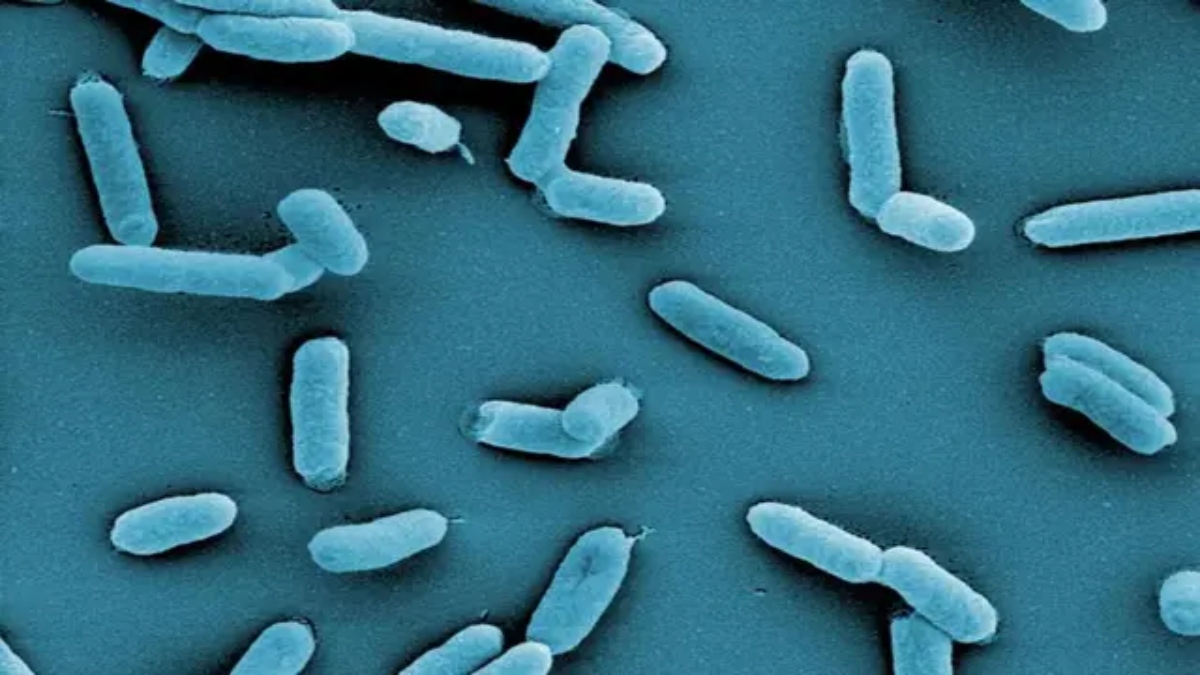 Low-Res_hzi_wiss_salmonella_mr_004-2