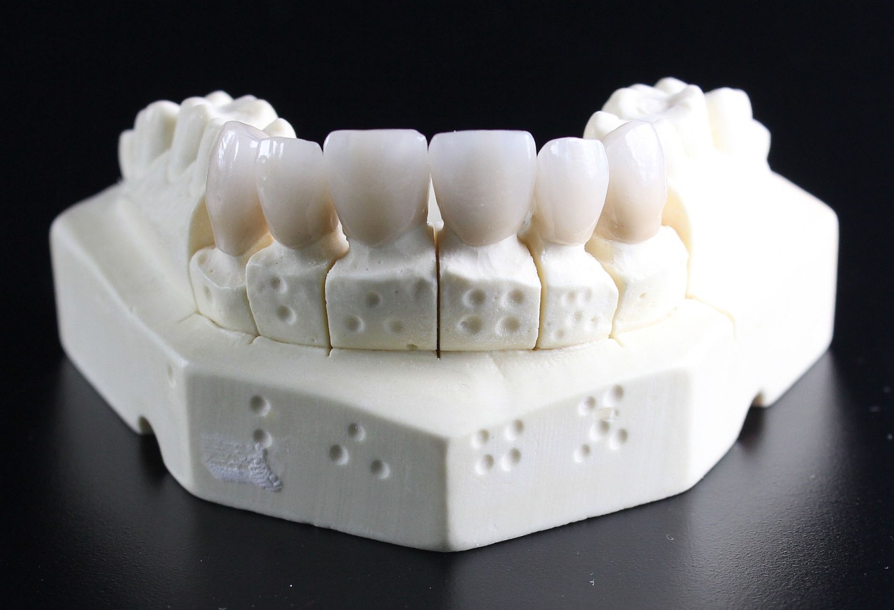 dentures-759929_1280