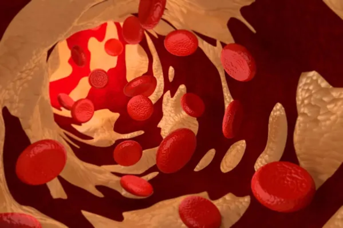 Cholesterol-2-jpg