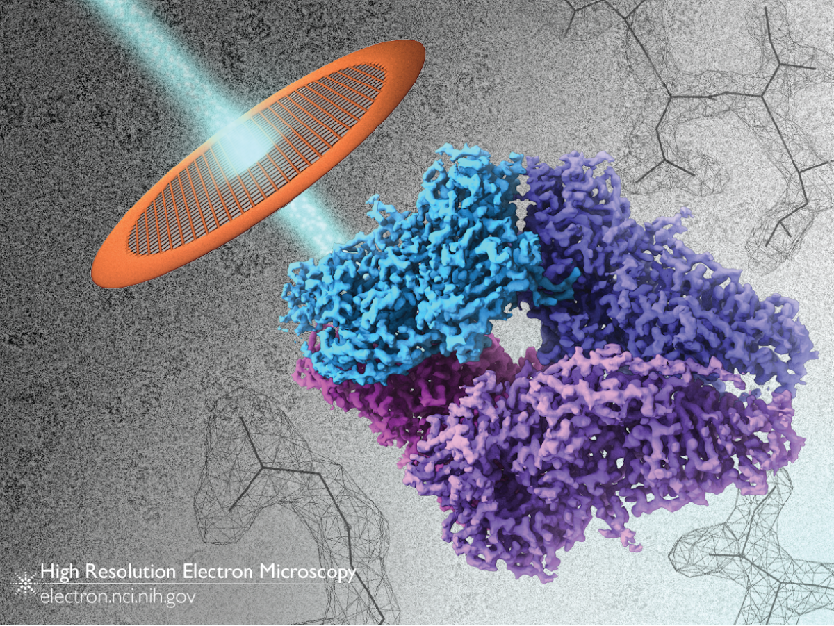 betagalactosidase-cryoem-gallerydl-1