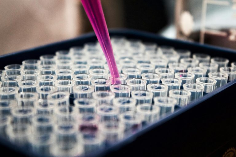Τη σχέση της ουρολοίμωξης με την κατανάλωση μολυσμένου κρέατος αναδεικνύει νέα έρευνα