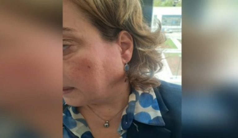 Ξυλοδαρμός γυναίκας δικηγόρου μέσα σε δικαστήριο – Αποκλειστικά η μαρτυρία της στο ΕΡΤnews