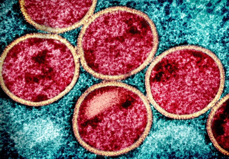 ΗΠΑ: Σε επιφυλακή οι υγειονομικές αρχές μετά τον εντοπισμό νέου στελέχους του ιού mpox