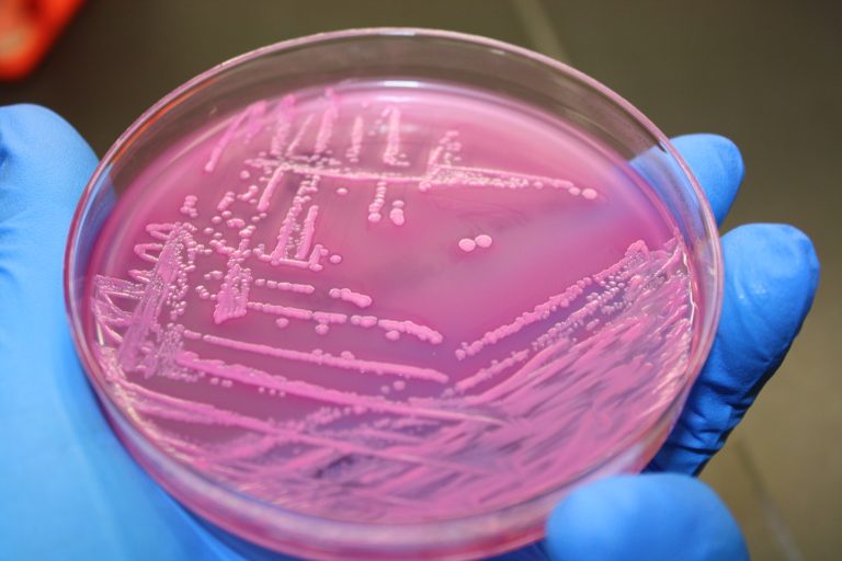 Tο E. coli εξαπλώνεται με την ίδια ταχύτητα με τον ιό της γρίπης των χοίρων