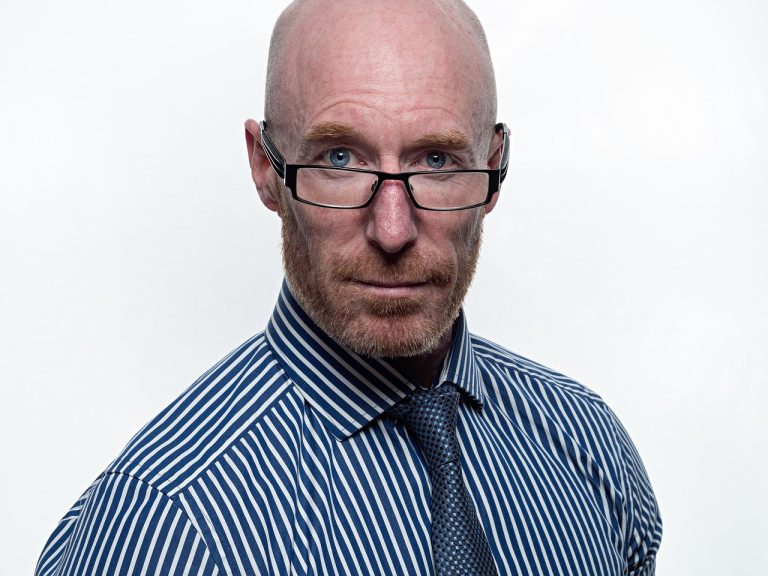 Πειραματικός ορός αντιστρέφει την απώλεια μαλλιών μέσα σε 20 ημέρες