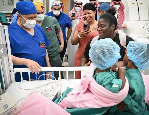 Σαουδική Αραβία: Επιτυχής Διαχωρισμός των Τζαμαϊκανών Διδύμων Αζάρια και Αζούρα Έλσον