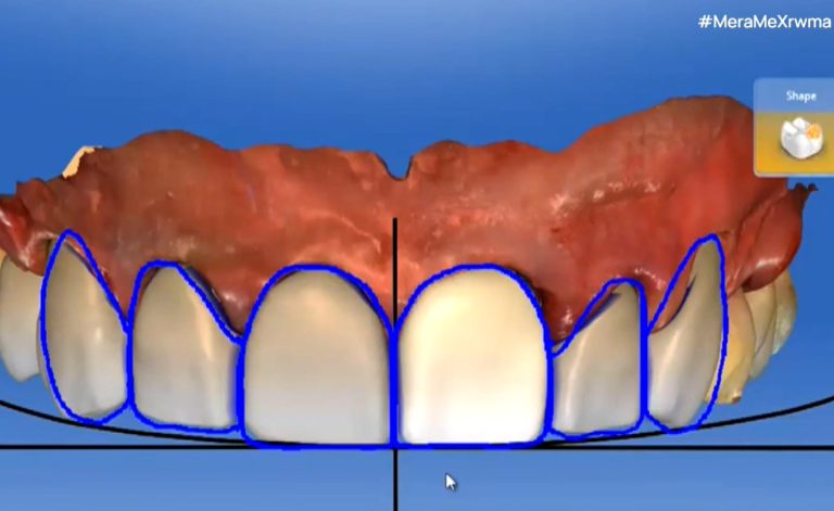 Τα οφέλη της ρομποτικής οδοντιατρικής για τους ασθενείς