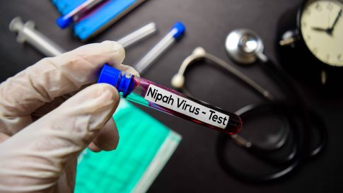 Το “Tinos Food Paths” αλλιώς! <br> – για φέτος…