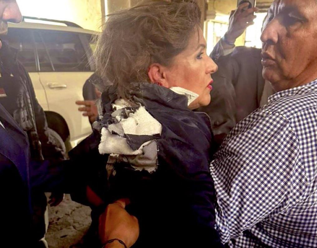 Ονδούρα: Τραυματίστηκε βουλευτής από εκρηκτικό μηχανισμό κοντά στο Κοινοβούλιο