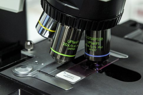 Βόλος: Δράση των κινητών ομάδων υγείας του ΕΟΔΥ στο Αγροτικό Ιατρείο Σούρπης