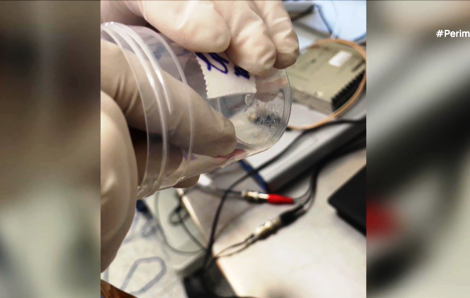 Διαγνωστική συσκευή εντοπίζει καρκινικά κύτταρα με ποσοστό επιτυχίας 98%