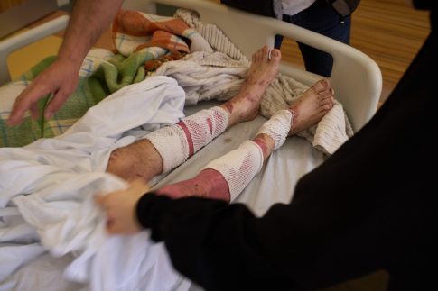 Σε οριακή κατάσταση βασικές κλινικές στην Πελοπόννησο – Παρέμβαση του αντιπεριφερειάρχη Υγείας Χ. Μέλλου για άμεση ενίσχυση