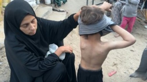 Σε άθλιες συνθήκες οι εκτοπισμένοι στη Γάζα: Aρουραίοι, ψύλλοι και άλλα παράσιτα εξαπλώνονται στους καταυλισμούς