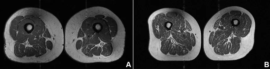 Προειδοποίηση επιστημόνων για τα υπερεπεξεργασμένα τρόφιμα: Η μαγνητική γυναίκας με τους μηρούς-μπριζόλα και ο «σιωπηλός» κίνδυνος