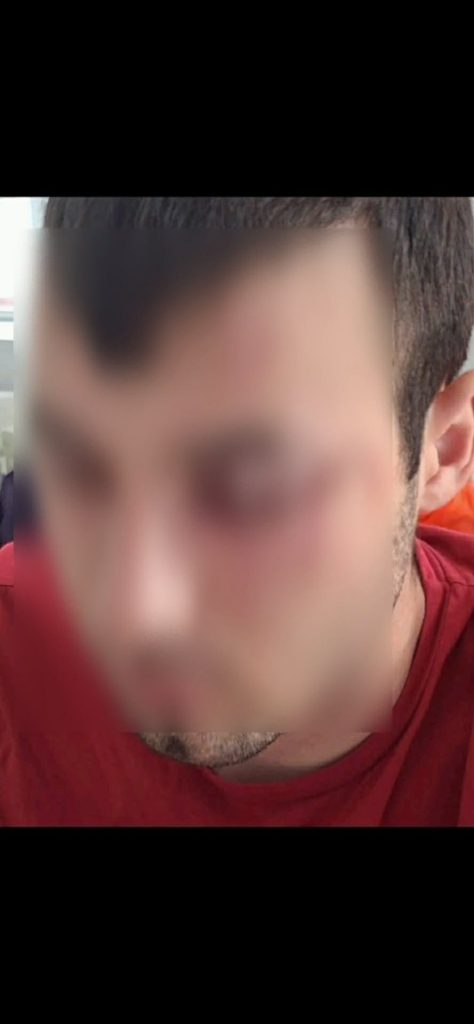 Αγρίνιο: Τρεις συλλήψεις για οπαδική επίθεση – Στο Nοσοκομείο ένας τραυματίας