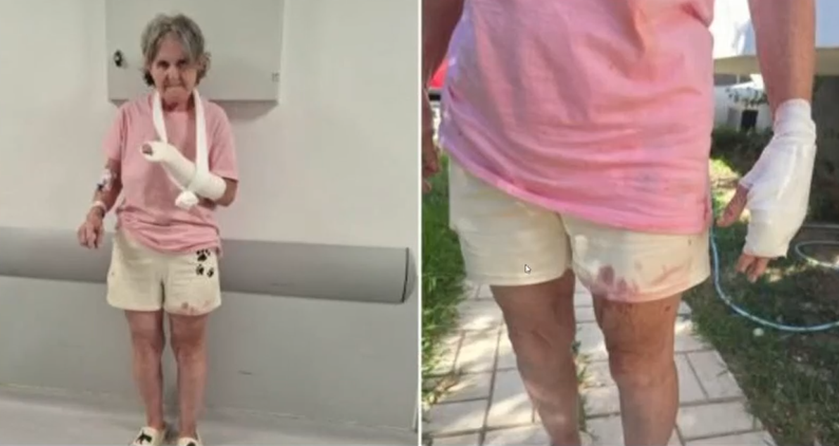 Τίνα Κασιδοκώστα στο ΕΡΤnews: Πώς με δάγκωσαν τα σκυλιά της οικογένειας Τσιτσιπά